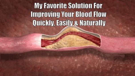 Poor Blood Flow & Circulation Treatments | Dr. Sam Robbins Circulation Remedies, Foods That Contain Calcium, Blood Circulation Remedies, Cleansing Foods, Clean Arteries, Hdl Ldl, Erectile Dysfunction Remedies, Calcium Deposits, Increase Blood Flow