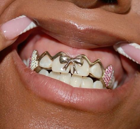 Girl Grillz, Pretty Teeth, Grillz Teeth, Diamond Grillz, Dope Jewelry Accessories, Grills Teeth, Tooth Gem, Expensive Jewelry Luxury, Gold Teeth