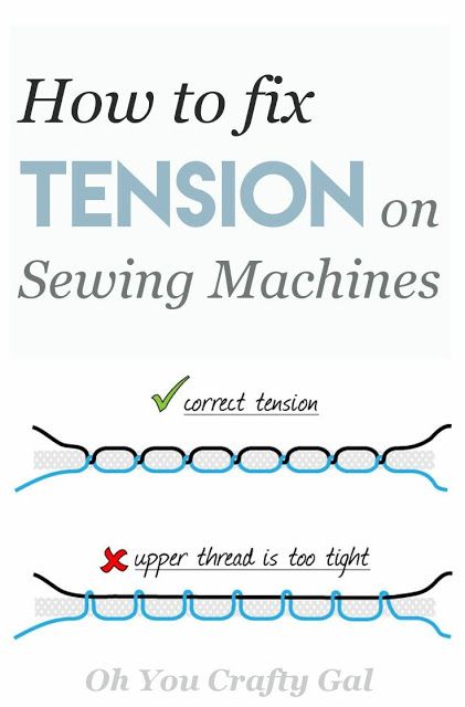 Sewing Machine Tension, Sewing Machine Repair, Illustration Tutorial, Sewing Machine Basics, Beginner Sewing Projects Easy, Sewing Stitches, Leftover Fabric, Sewing Lessons, Sewing Projects For Beginners