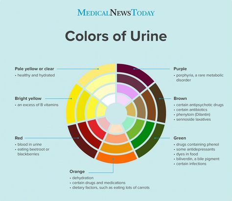 What causes dark urine? Green Urine, Pee Color, Color Of Urine, Urine Color, Birth Colors, Shingle Colors, Metabolic Disorders, Color Meanings, Red Blood Cells