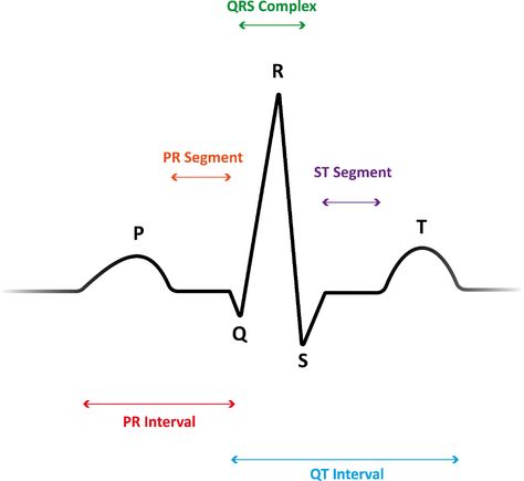 5-Lead ECG Interpretation, Electrocardiogram Tips for Nurses Cardiac Arrhythmias, Ekg Tech, Telemetry Nursing, Ekg Rhythms, Ekg Interpretation, Ecg Interpretation, Nursing Cheat, P Wave, Nurses Station