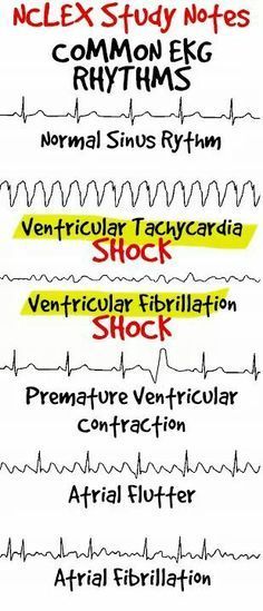 Nursing Cheat, Nursing Board, Nclex Study, Nursing Mnemonics, Nursing School Survival, Cardiac Nursing, Nursing School Studying, Nursing School Tips, Nursing School Notes