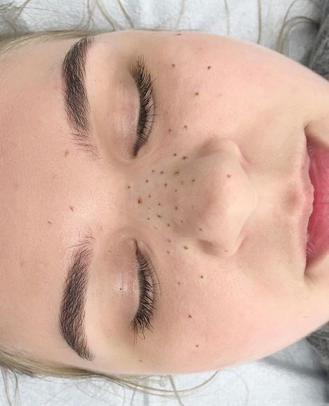 Tattoo Freckles, Makeup Freckles, Freckle Tattoo, Tattooed Freckles, Freckles Makeup, Faux Freckles, Natural Glowy Makeup, Face Tattoos, Glowy Makeup