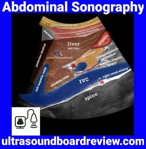 Abdominal Anatomy Abdominal Anatomy, Ultrasound Student, Diagnostic Medical Sonography Student, Abdominal Ultrasound, Ultrasound School, Medical Radiography, Cardiac Sonography, Vascular Ultrasound, Sonography Student