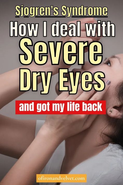 Dry Eye Remedies, Eye Health Remedies, Remedies For Dry Mouth, Chronic Dry Eye, Dry Eyes Causes, Dry Eye Symptoms, Warts Remedy, Natural Remedies For Migraines, Eye Pain