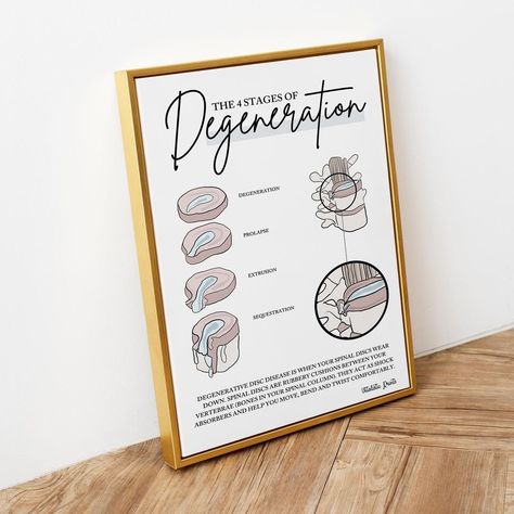 Vitalisticprints on Instagram: “The 4 Stages Of Disc Degeneration. Check out our Etsy store or website for the two other prints in this range, also the customised canva…” Logo Clinic, Spinal Degeneration, Chiropractic Art, Chiropractic Office Design, Nude Background, Price List Design, Chiropractic Clinic, Spinal Nerve, Massage Business