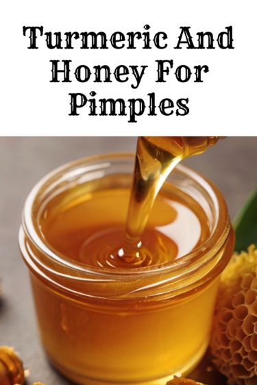 Turmeric And Honey For Pimples Honey For Pimples, High Glycemic Foods, Turmeric And Honey, Acne Overnight, Pimples Overnight, Acne Skincare, The Dream Team, Acne Skincare Routine, Types Of Acne