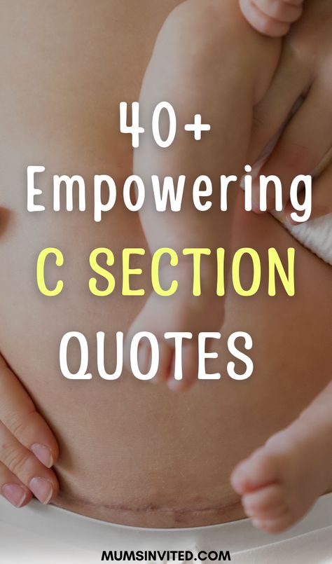 Looking for inspiration and support as a mom who has had a c-section? These c-section quotes are filled with love, positivity, and messages of strength. Whether you're looking for something to lift you up on a tough day or simply want to celebrate the unique strength and beauty of c-section motherhood, these quotes have you covered. So let's embrace the power of the c-section mom and find inspiration in these uplifting words C Section Quotes Strength, C Section Quotes Inspiration, C Section Awareness Month Quotes, C Section Mom Quotes, C Section Quotes, Bible Verse For Daughter, Fatherhood Quotes, Prayers For My Daughter, Beauty Of Motherhood