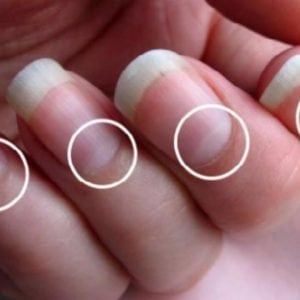 Moons On Fingernails, Nail Health Signs, Fingernail Health, Nail Room Ideas, Half Moon Nails, Moon Nails, Easy Nails, Nail Pictures, Brittle Nails