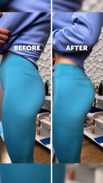 5-Minute Crafts on Instagram: "Butt vacuum therapy: how it works 😳 #vacuumtherapy #glutevacuum #beautytreatment #bodytreatment #howitsdone #beforeafter" Vacuum Therapy, Body Treatments, Beauty Treatments, Acupuncture, 5 Minute Crafts, It Works, On Instagram, Instagram