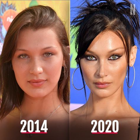 Nicki Swift on Instagram: “Happy 24th birthday to Bella Hadid! 🎈🎂 In honor of her birthday, check out this incredible 6 year transformation!” Year Transformation, Happy 24th Birthday, Almond Shaped Eyes, Cosmetic Injectables, Video Gif, Bella Hair, High Cheekbones, 24th Birthday, Bella Hadid