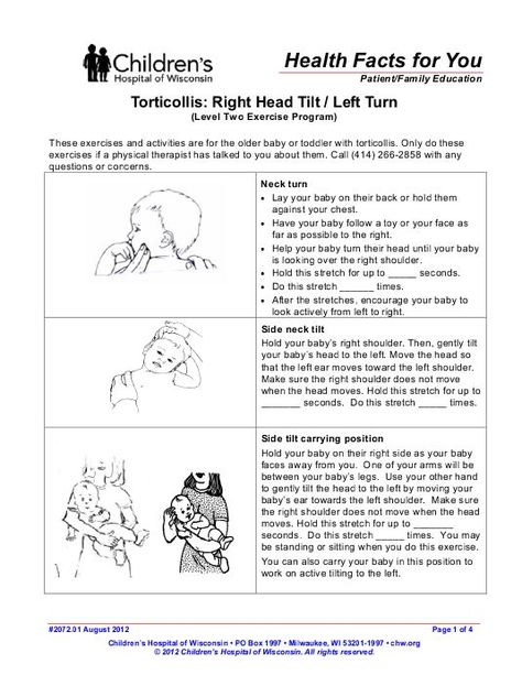 Torticollis Right Head Tilt/Left Turn - Children's Hospital of Wisconsin https://www.yumpu.com/en/document/view/50874477/torticollis-right-head-tilt-left-turn-childrens-hospital-of-wisconsin Pediatric Notes, Early Intervention Occupational Therapy, Pediatric Physical Therapy Activities, Physiotherapy Exercises, Occupational Therapy Kids, Infant Lesson Plans, Daycare Forms, Pediatric Physical Therapy, Head Tilt