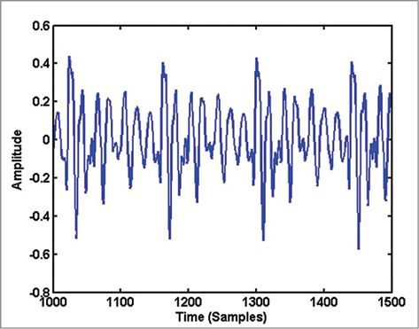 Understanding Spectrogram of Speech Signal Using MATLAB Program Software Projects, Signal Processing, Electronics Projects, Electronics