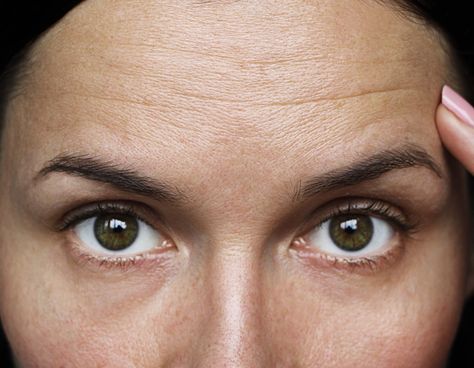 The Best Anti-Aging Ingredients for Diminishing Forehead Wrinkles Frown Lines, Smile Lines, Forehead Wrinkles, Facial Exercises, Anti Aging Ingredients, Wrinkled Skin, Glowing Complexion, Best Anti Aging, Sagging Skin