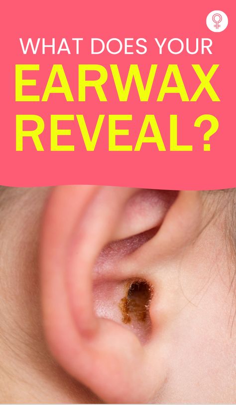 What Does Your Earwax Reveal? The color of the earwax varies from person to person and essentially speaks about the person’s genetic origin. It also shows the amount of secretions produced by the apocrine glands (the glands that secrete an oil-like substance to form earwax) and suggests the presence of a possible medical condition. #earwax #health #healthcare #healthtips Ear Wax Removal Video, Impacted Ear Wax, Outer Ear, Cleaning Your Ears, Ear Wax Removal, Health Podcast, Color And Texture, Dark Wax, Ear Cleaning