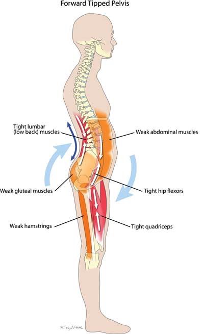 Release your back pain in 5 minutes Psoas Release, Back Muscle, Gluteal Muscles, Lower Back Muscles, Yoga Anatomy, Pelvic Tilt, Tight Hip Flexors, Muscle Imbalance, Hip Flexors