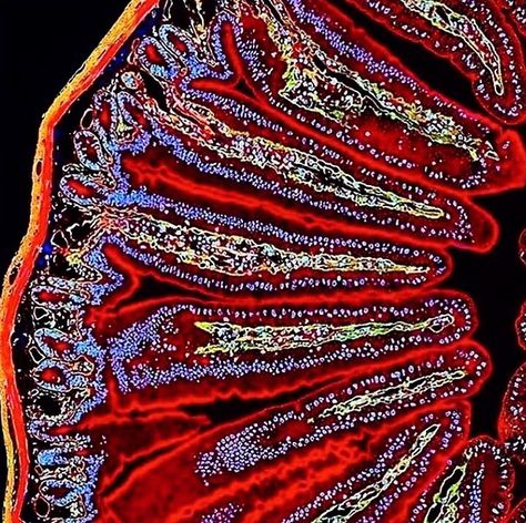 Beyond The Graphs on Instagram: “OH MY GUT! It’s full of bacteria, and it’s beautiful ☺️ this is a close up of the small intestine where we absorp nutrients and minerals…” Microbiology Bacteria, Biology Science, Human Animal, Small Intestine, Gut Bacteria, Microbiology, Zoology, Animal Planet, Double Tap