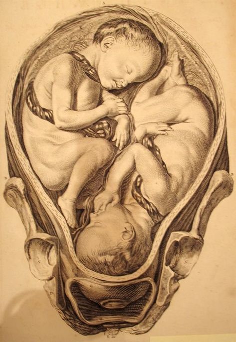 Twins In The Womb, Baby In Womb, Birth Art, Pregnancy Art, Human Anatomy Art, Vintage Medical, Medical Art, Scientific Illustration, Medical Illustration