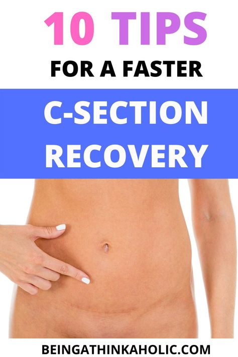 Postpartum Products, C Section Recovery Timeline, Postpartum Workouts, C Section Scars, Emergency C Section, C Section Recovery, Cesarean Section, Abdominal Surgery, Key To Losing Weight