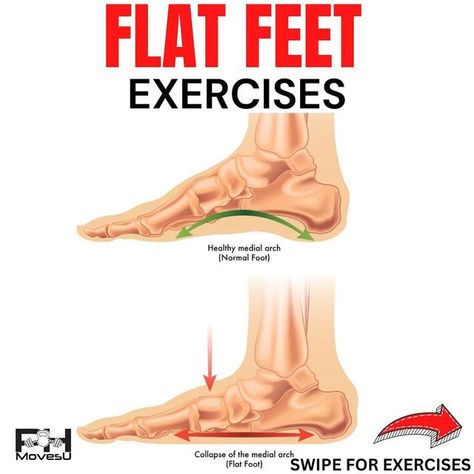 Peter Hanc on Instagram: "💥Flat Feet💥 - ⁉️ Have a flat feet?! - 💥 Having flat feet doesn't mean much as shape of your arch is largely determined by genetics, so thinking about building up your foot strength is the way to go - as it will improve stress tolerance, control, and balance, which transfers into better foot function and less aches and pains if you experience any. - 🎥 Exercises shown here: - 1️⃣ Short Foot with Towel Feedback 2️⃣ Big Toe/Little Toes Taps 3️⃣ Arch Contract/Relax 4️⃣ D Ankle Rehab Exercises, Flat Feet Exercises, Yoga Asanas Names, Flat Feet Pain, Plantar Fascitis, Physical Therapy School, Heel Spur, Feet Therapy, Foot Exercises