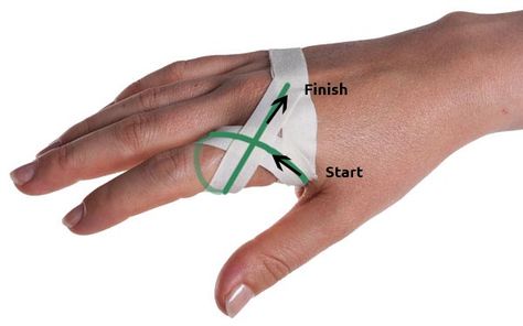 This is a GREAT site! Sprained Knuckle Taping Step 2 | Physical Sports First Aid; 1/16/2016 - this helped my pain more than just about anything else i tried (RSI - index joint at the hand); *I used sensitive skin paper tape under the adhesive tape to reduce skin damage from removal; See also Thumb Spica Taping. How To Tape Fingers For Volleyball, Athletic Training Sports Medicine, K Tape, Kinesio Tape, Kinesio Taping, Sports Therapy, Sports Tape, Kinesiology Taping, Basketball Workouts