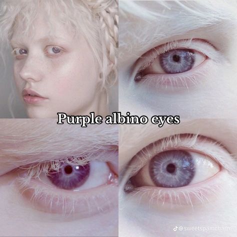 Heterochromia Eyes Aesthetic, Albino Eyes, Pretty Eyes Color, Rare Eye Colors, Eye Color Chart, Rare Eyes, Beautiful Eyes Color, Types Of Eyes, Aesthetic Eyes