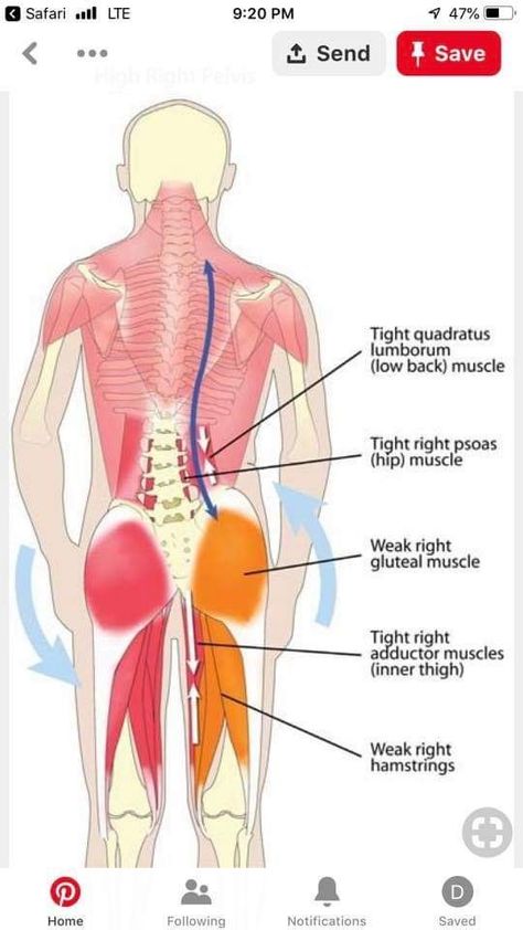 Misaligned Pelvis, Ql Muscle, Quadratus Lumborum, Healthy Spine, Gluteal Muscles, Muscle Imbalance, Muscle Anatomy, Massage Benefits, Hip Muscles