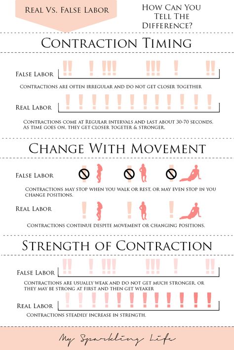 Real vs False Labor | How To Tell If It's Truly Miracle Time False Labor, Pregnancy Info, Pregnancy Labor, Pregnancy Information, Pumping Moms, Birth Labor, Baby Sleep Problems, Baby Advice, Baby Prep