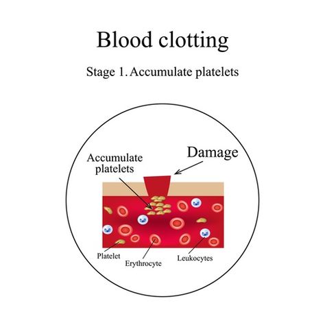 von Willebrand Disease Von Willebrand Disease, Medical School Studying, White Blood Cells, Red Blood Cells, Natural Therapy, Health Information, Medical School, Disease, All In One