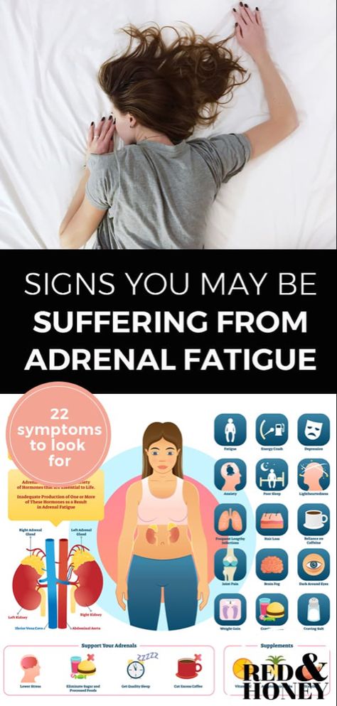 Adrenal Fatigue Symptoms Signs, Low Thyroid Remedies, Thyroid Remedies, Adrenal Fatigue Symptoms, Fatigue Symptoms, Low Estrogen Symptoms, Low Thyroid, Too Much Estrogen, Adrenal Health