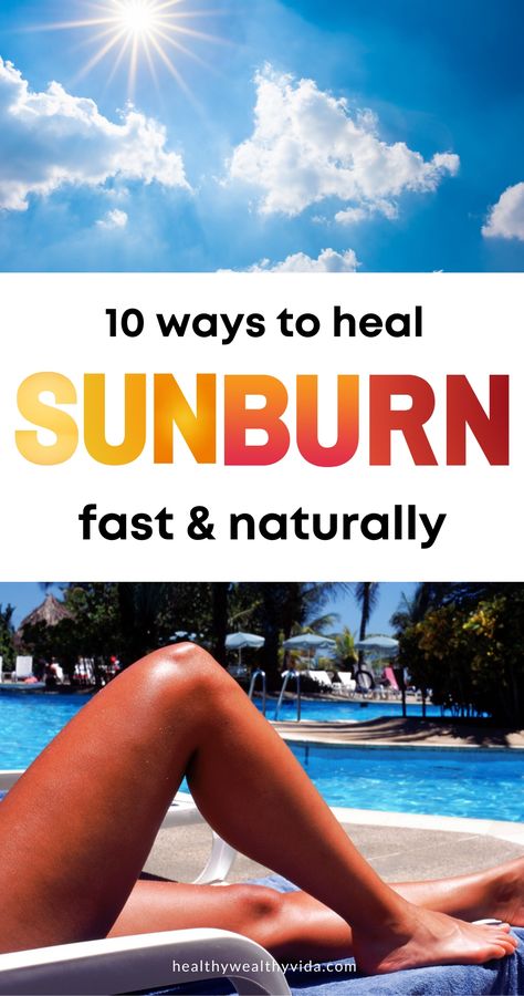 Burned Skin Remedies, Heal Sunburn Fast, Sunburn On Face, Best Remedy For Sunburn, Really Bad Sunburn, Best For Sunburn, Sunburn Face, How To Help Sunburn, Home Remedies For Face