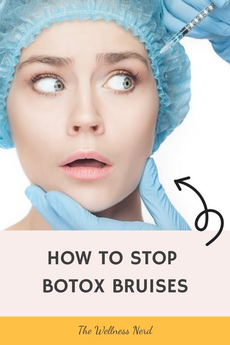 Bruising is the most common side effect that might happen after having Botox injections but with a few changes to your routine before and after your injectables appointment you can reduce the risk of it happening to you. Here's what our experts suggest. Nyx Colour Correcting Palette, Face Injections, Facial Injections, Botox Injections, Best Spa, Color Corrector, Dermal Fillers, Healthy Beauty, Lip Fillers