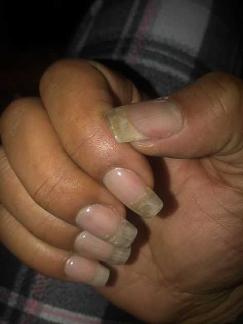 Clear acrylic overlay on natural nails Clear Natural Nails, Acrylic Overlay On Natural Nails, Overlay On Natural Nails, Clear Gel Nails, Clear Acrylic Nails, Acrylic Overlay, Power Of Makeup, Nail Envy, Clear Nails