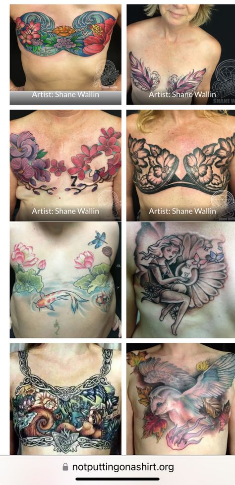 Aesthetic Flat Closure Mastectomy, Tattoos Asian, Mastectomy Tattoo, Scar Tattoo, Chest Tattoos For Women, Chest Tattoos, Breast Surgery, Top Tattoos, Memorial Tattoos