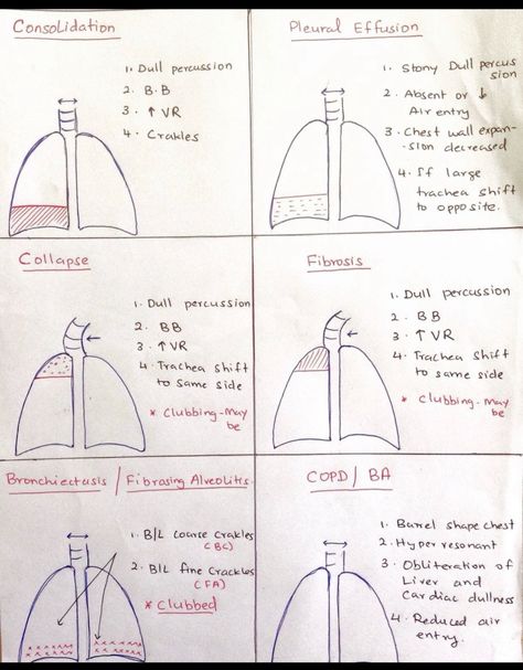 Respiratory Care Practitioner, Respiratory System Disorders, Breathing Patterns Respiratory, Respiratory Disorders Nursing, Emt Respiratory Emergencies, Tmc Respiratory Exam, Respiratory System Nursing Notes, Respiratory Physiotherapy, Respiratory Therapist Aesthetic