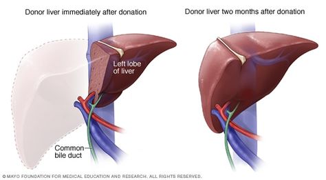 Donate Life, Liver Failure, Bile Duct, Organ Donor, Organ Donation, The Dating Divas, Surgery Recovery, Body Organs, Mayo Clinic