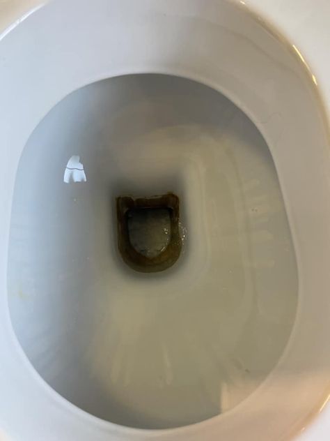 How to remove limescale from toilet bowl - Cleaning Express Remove Limescale From Toilet, Toilet Ring Remover Hard Water, How To Remove Limescale From Toilet, How To Keep Toilet Bowl Clean, Stained Toilet Bowl How To Remove, How To Clean Toilet, Cleaning Toilet Ring, Toilet Ring Remover, Clean Toilet Bowl Stains