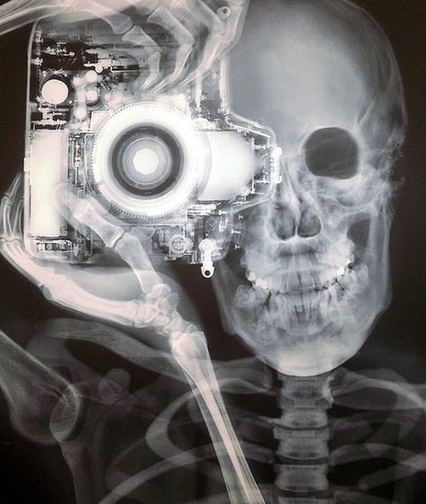 X-ray Image of a Nikon Photographer in love <3 <3 Holding A Camera, Xray Art, X-ray Images, Tech Week, Rad Tech, A Skeleton, Foto Art, A Skull, Radiology