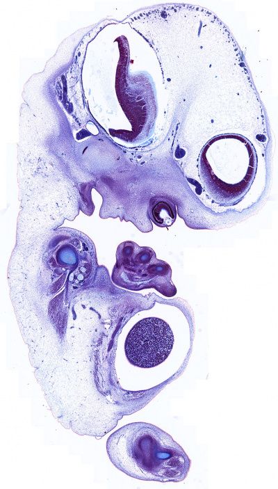 Carnegie stage 18 - Embryology Embryology Aesthetic, Embryology Art, Rehabilitation Aesthetic, Nephrology Art, Embryo Drawing, Transformation Reference, Embryo Art, Science Artwork, No Emotions