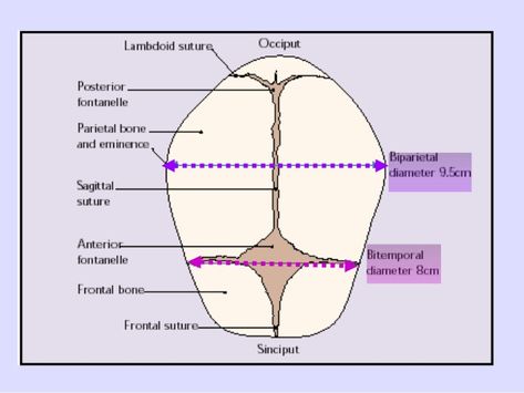 Fetal Skull Dimensions : Mnemonic - https://epomedicine.com/medical-students/fetal-skull-dimensions-mnemonic/ Fetal Heart Rate Chart, Fetal Heart Rate Gender, Fetal Growth Restriction, Fetal Skull Diagram, Fetal Heart Monitoring, Medical Students, Homeschool Ideas, Nursing, Anatomy