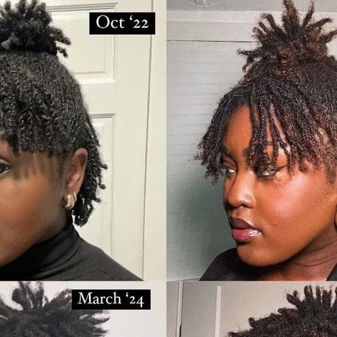 Katty’s Loc Journey on Instagram: "Im more shocked at how much it grew from March this year to August today! Tomorrow will be 22 months locs and im excited to see how it looks during year 2 this October! Growth was slow at first but now it’s moving fast!

#microlocs #locs #locstyles #microlocjourney #locjourney" Micro Locs, Loc Journey, Im Excited, Loc Styles, Year 2, Locs, Then And Now, Medium Length, This Year