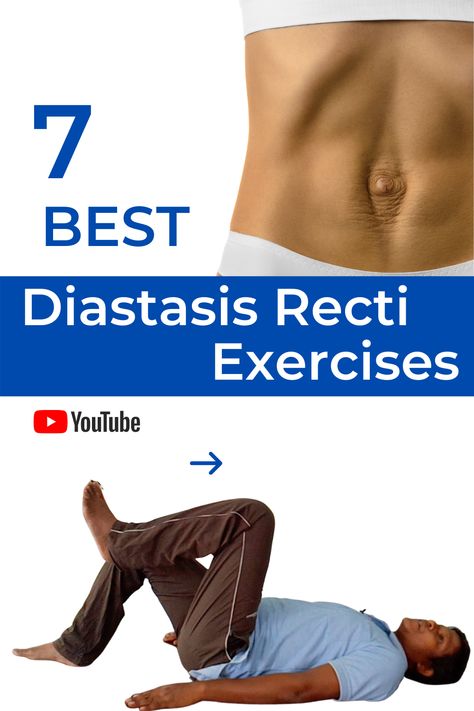 After delivery/ C-Section diastasis recti issue is common among ladies. Here's 7 best exercises to manage it effectively. Exercises Postpartum, Rectus Abdominis Muscle, Rectus Abdominis, Diastasis Recti Exercises, A Separation, Diastasis Recti, Best Exercises, C Section, After Baby