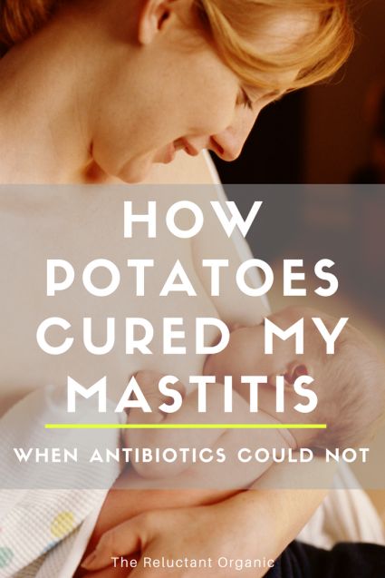 Mastitis Remedies At Home, Bf Tips, Mastitis Remedies, Blocked Milk Duct, Birth Prep, Clogged Duct, Natural Antibiotic, Natural Antibiotics, Natural Lifestyle