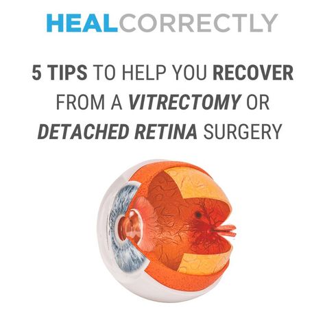 Steve, Co-Owner of Retina Recovery Inc. located in London, Ontario, Canada, shares a few insights on ways to recover successfully (and comfortably!) from a vitrectomy based on his personal experience. Recovering from detached retina surgery or a vitrectomy can be a challenge. But it doesn't have to be painful on your back, neck and hips! Vitrectomy Surgery, Retina Surgery, Surgery Recovery, Eye Surgery, London Ontario, Dry Eyes, Ontario Canada, Surgery, Ontario