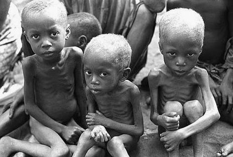 Poverty In Africa, Global Poverty, Suri Cruise, Hungry Children, World Hunger, World Vision, African Children, Poor Children, We Are The World