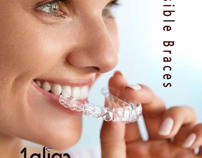 Invisalign Aligners, Straight Smile, Invisalign Braces, Traditional Braces, Clear Braces, Dental Surgeon, Crooked Teeth, Teeth Straightening, Metal Braces