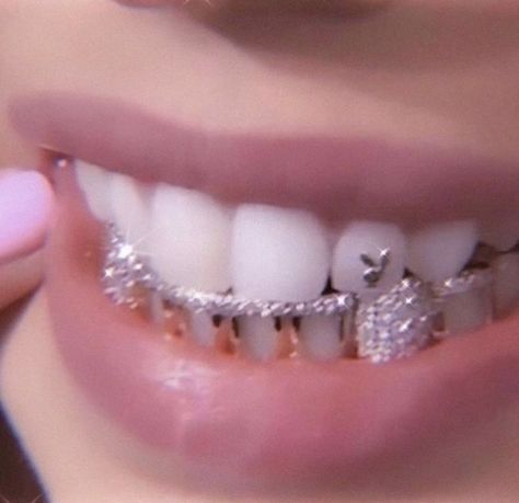 Braces, Diamonds