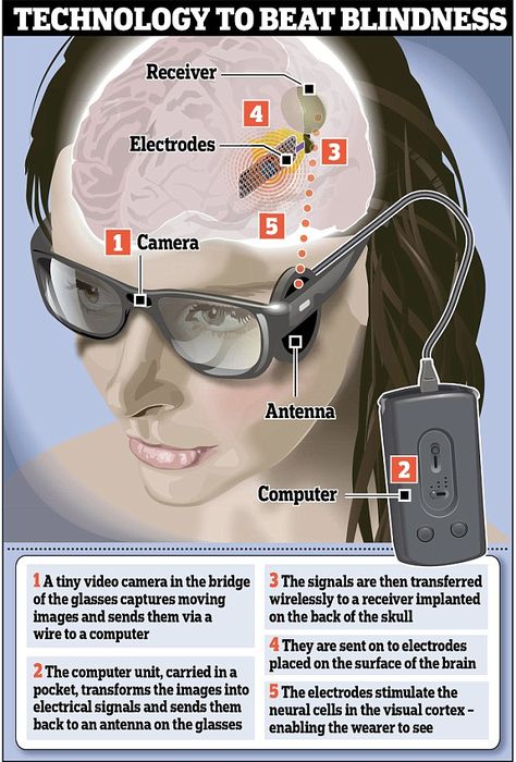 The diagram shows how the new bionic eye would work, sending signals directly to the brain. The computer sends signals to the antenna, which is connected to the brain Blind Woman, Bionic Eye, Tiny Camera, Black Art Pictures, First Humans, Futuristic Technology, Alternative Health, Video Camera, Eye Art