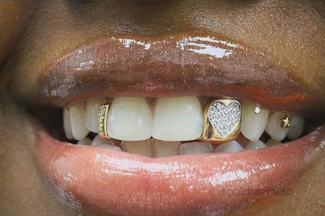 Girls With Grills, Girl Grillz, Grillz Teeth, Looks Hip Hop, Diamond Grillz, Maquillage On Fleek, Gold Grillz, Grills Teeth, Tooth Gem