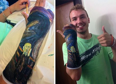 Arm Cast Painting, Broken Arm Cast, Cast Decoration, Bored Women, Scream Cast, Arm Cast, Leg Cast, Cast Art, Women Laughing